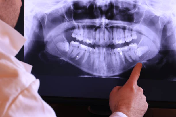 Best After-Hours Emergency Dentist in Reinbeck, IA